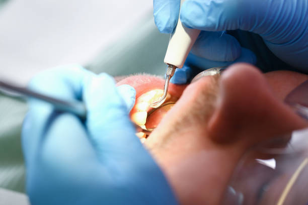 Best Affordable Emergency Dental Care  in Bourg, LA