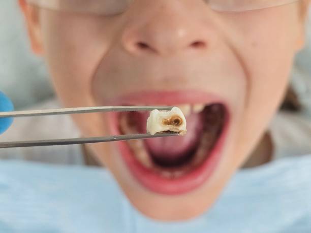 Best Affordable Emergency Dental Care  in Bourg, LA